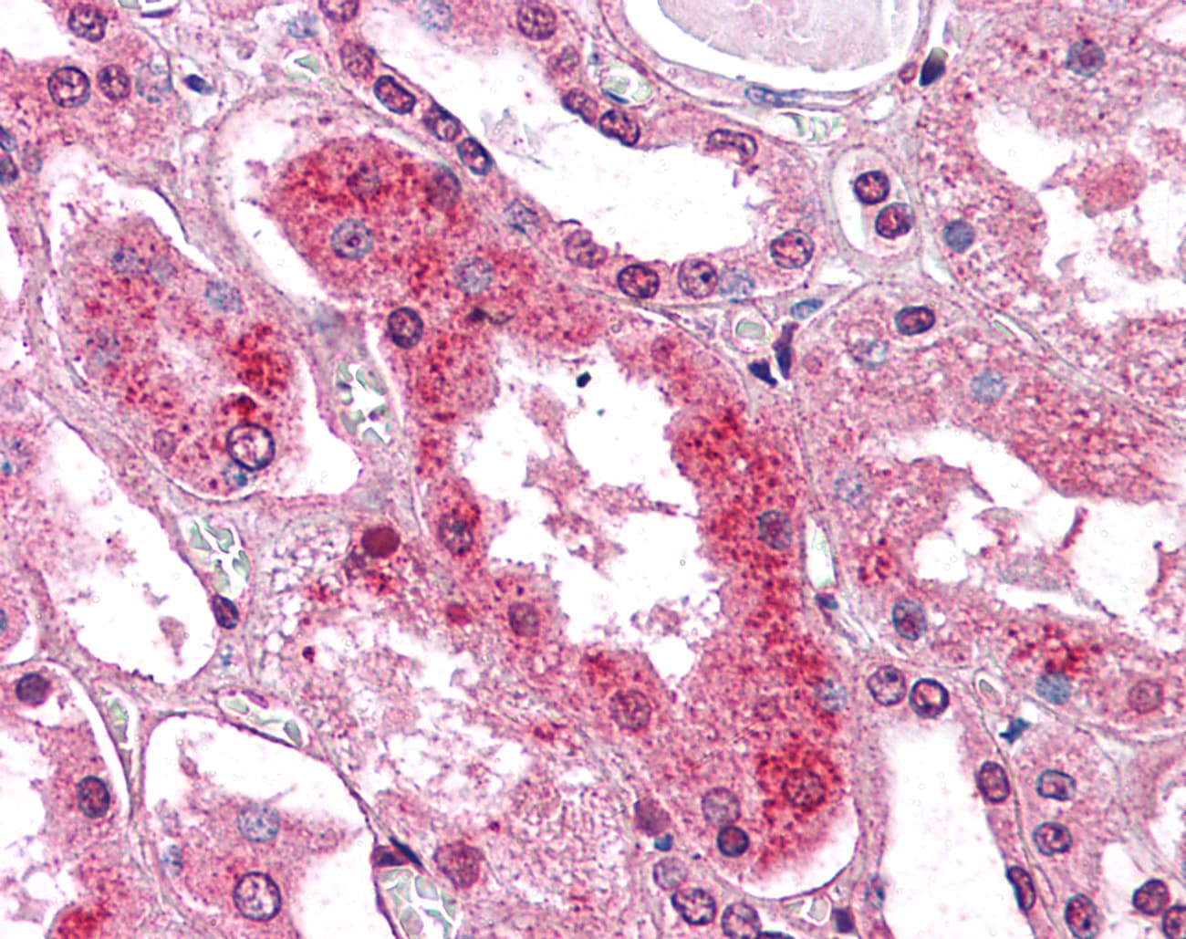 IHC-plus™ Polyclonal Rabbit anti-Human GM2A Antibody (C-Terminus, IHC)