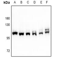 Polyclonal Rabbit anti-Human F13A1 / Factor XIIIa Antibody (WB)