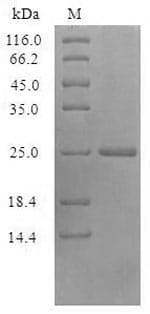 Vaccinia Virus VACWR074 Protein (Recombinant 6His-SUMO, N-terminus)