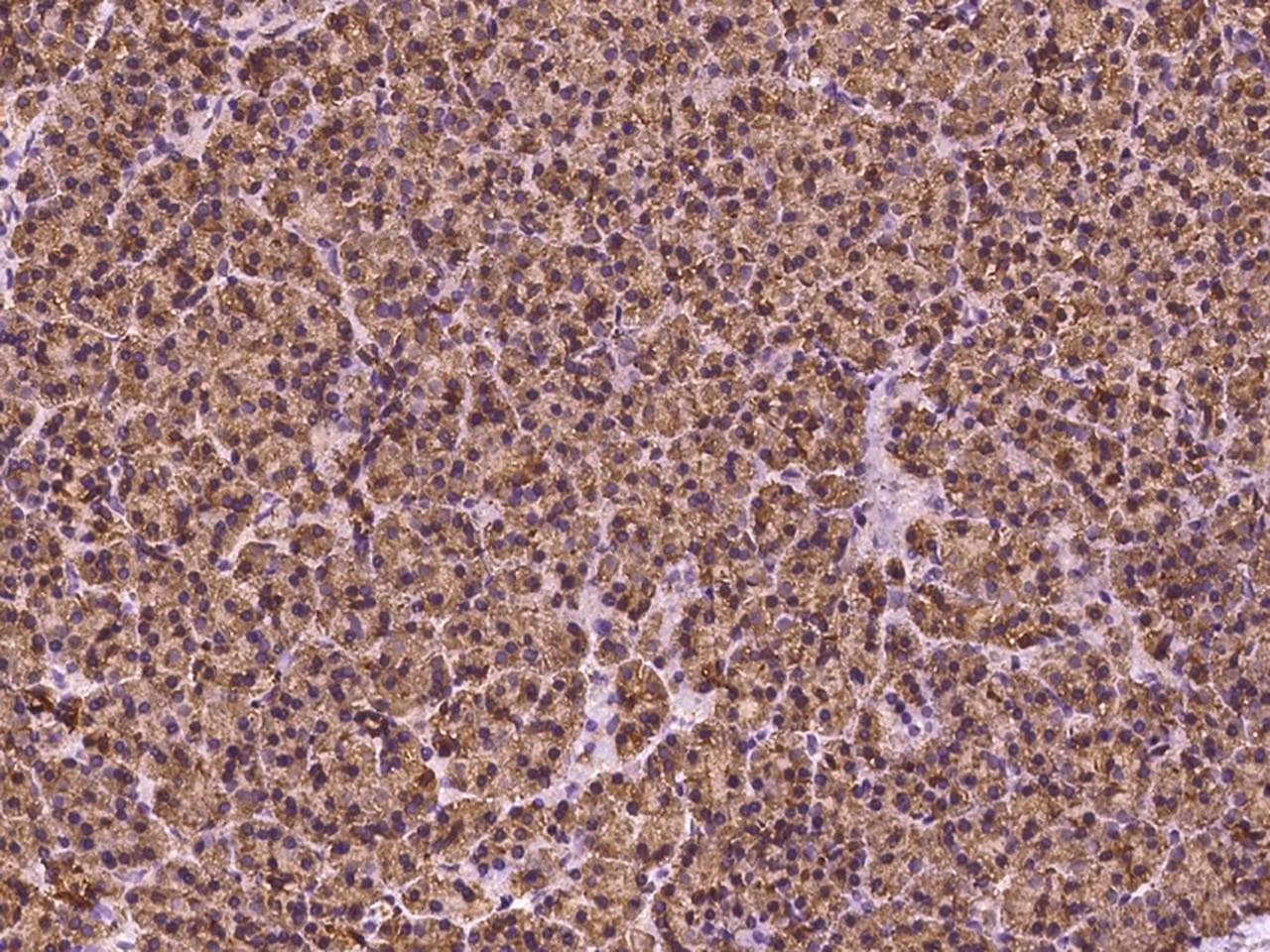 HEATR4 Antibody