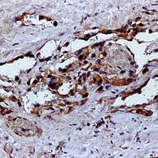 VEGFA / VEGF Antibody (clone VG1)