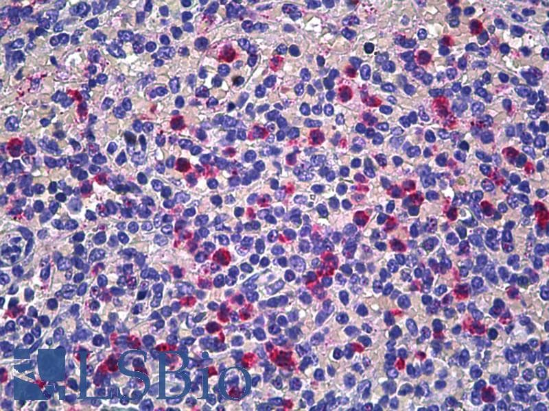 IHC-plus™ CD177 Antibody (clone 4C4)