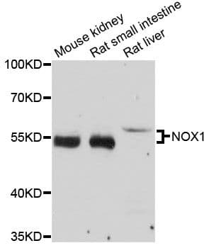 Polyclonal Rabbit anti-Human NOX1 Antibody (WB)