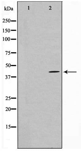 FGFR1OP / FOP Antibody