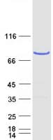 Human CENTB1 / ACAP1 Protein (Recombinant Myc-DDK (Flag))