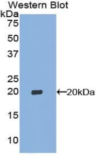 p16INK4a / CDKN2A Antibody (aa3-154, Mouse sequence)