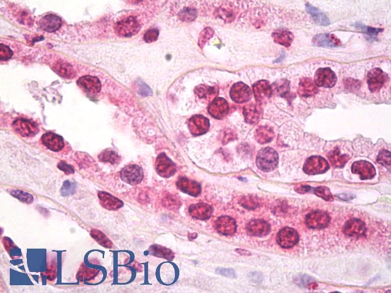 IHC-plus™ HSF1 Antibody (clone 10H8)