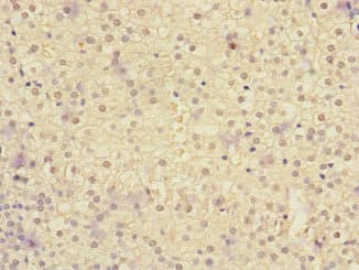 Polyclonal Rabbit anti-Human IL20RA Antibody (IHC)