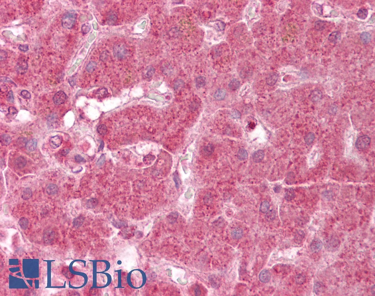 IHC-plus™ Polyclonal Rabbit anti-Human NDUFA13 / GRIM19 Antibody (IHC, WB)