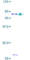 Human CDK9 Protein (Recombinant GST)