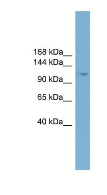TRIM37 / TEF3 Antibody (C-Terminus)