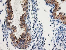 AK4 / Adenylate Kinase 4 Antibody (clone OTI3B1, Carrier-free)