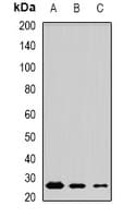 MSRB3 Antibody