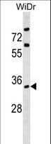 Polyclonal Rabbit anti-Human ARPC2 / p34-Arc Antibody (aa263-291, WB)