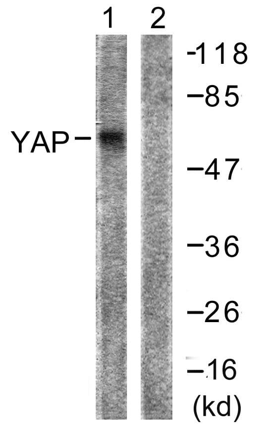 Polyclonal Rabbit anti-Human YAP / YAP1 Antibody (p127, WB)
