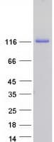 Human JMY Protein (Recombinant Myc-DDK (Flag))