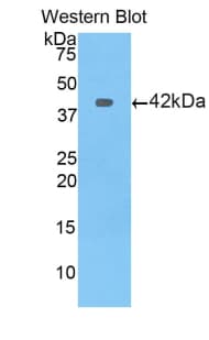 PFN1 / Profilin 1 Antibody (aa2-140)