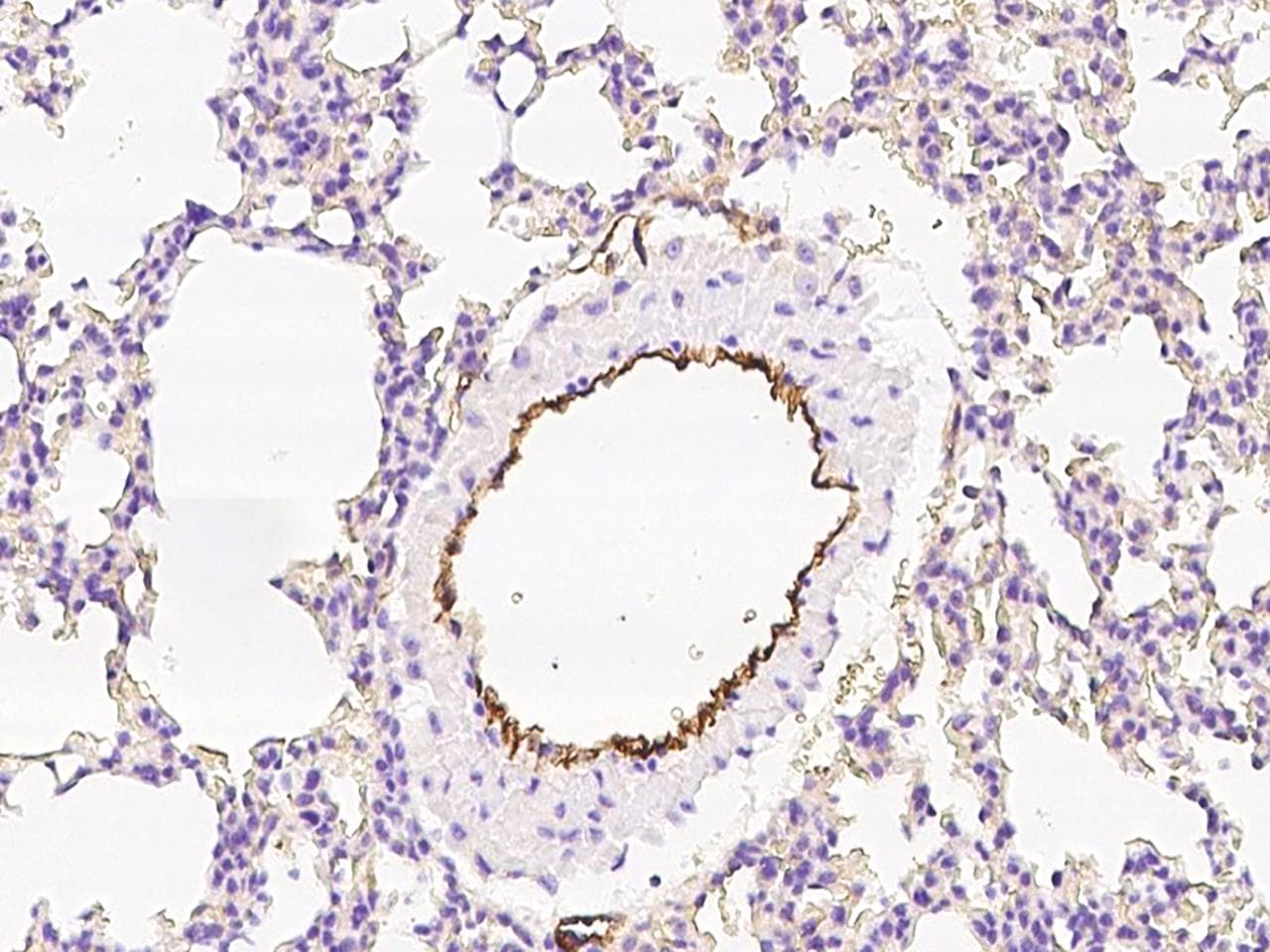 PROCR / EPCR Antibody (Preservative Free)