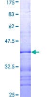 Human BAD Protein (Recombinant GST, N-terminus)