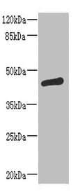 Polyclonal Rabbit anti-Human ST6GALNAC2 Antibody