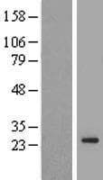 TMEM222 Protein (Over-Expression Lysate Myc-DDK (Flag))