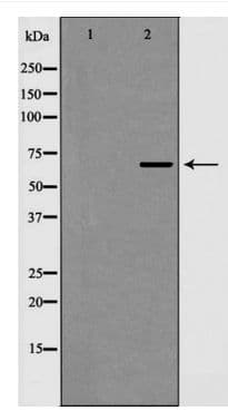 Polyclonal Rabbit anti-Human EIF4B Antibody (IHC, IF, WB)