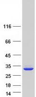 Human QDPR / DHPR Protein (Recombinant Myc-DDK (Flag))