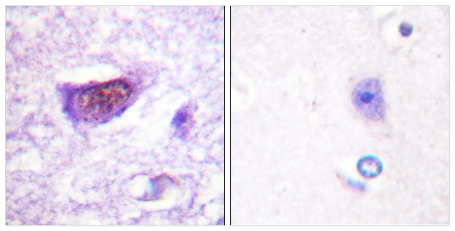 SF1 Antibody (phospho-Ser82)