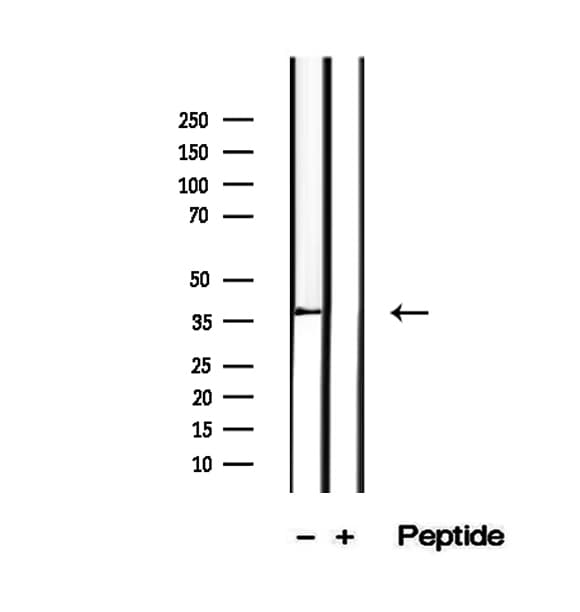 PIK3IP1 / HGFL Antibody