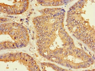 ZNF2 Antibody