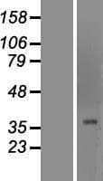 BF1 / FOXG1 Protein (Over-Expression Lysate Myc-DDK (Flag))