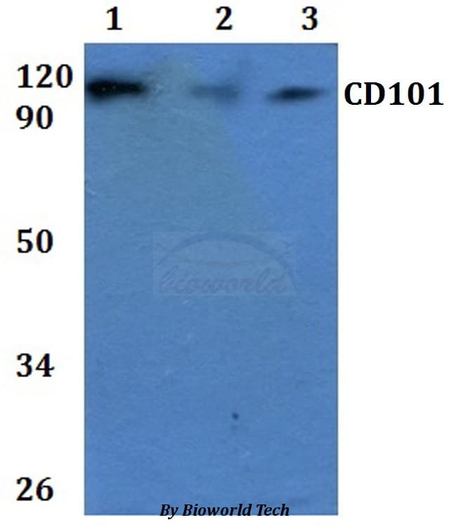 Polyclonal Rabbit anti-Human CD101 Antibody (WB)
