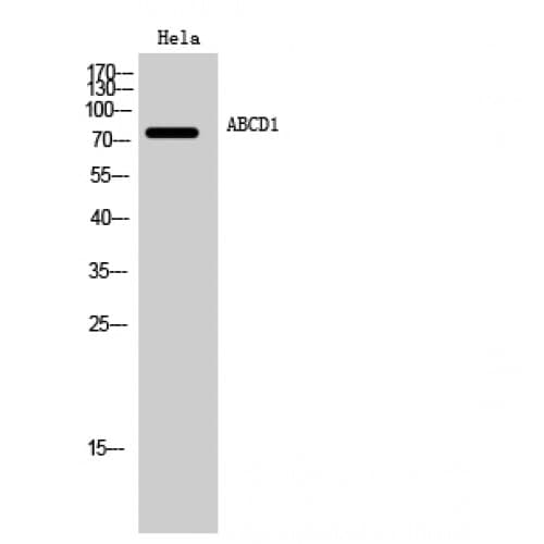 ALDP / ABCD1 Antibody (500-580 aa, Internal)