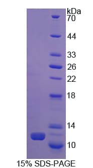 Pig CCL5 / RANTES Protein (Recombinant His)