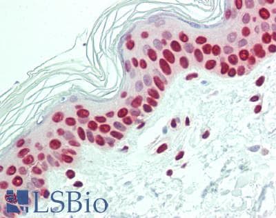 IHC-plus™ Polyclonal Rabbit anti-Human PPP2R2A Antibody (aa126-160, IHC, WB)