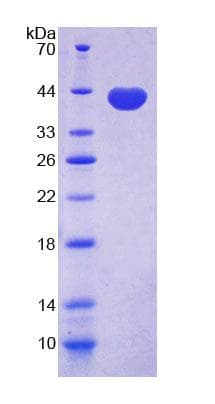 Mouse CD144 / CDH5 / VE Cadherin Protein (Recombinant His-T7)