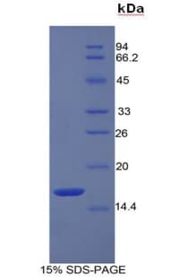Human REG3A Protein (Recombinant 6His, N-terminus)