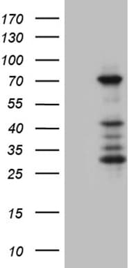 ASH2L / ASH2 Antibody (aa347-628, clone OTI10D8)