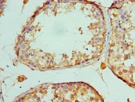 IHC-plus™ MAP2K5 / MEK5 Antibody (aa1-190)