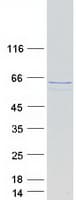 Human ANXA11 / Annexin XI Protein (Recombinant Myc-DDK (Flag))