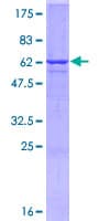 Human SYP / Synaptophysin Protein (Recombinant GST)