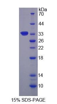 Human RPS6KA1 / RSK1 Protein (Recombinant His-S)