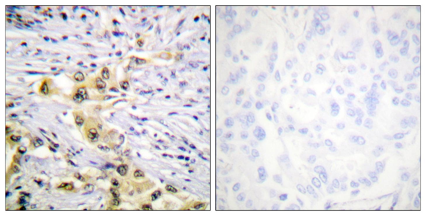 IGF2R / CD222 Antibody
