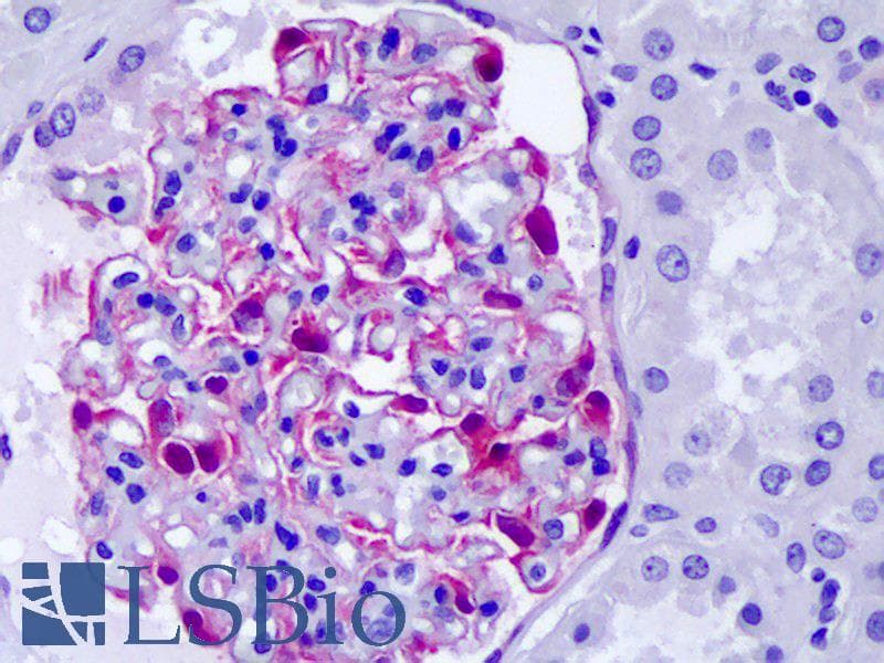 IHC-plus™ CLIC5 Antibody (clone 1E6)