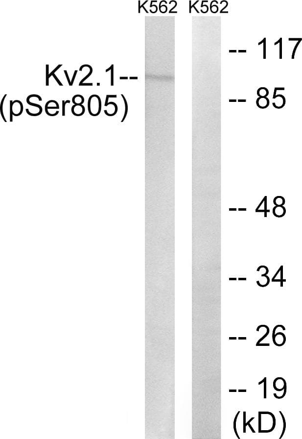 KCNB1 / Kv2.1 Antibody (phospho-Ser805)