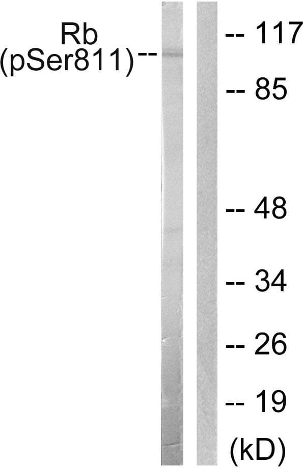 RB1 / Retinoblastoma / RB Antibody (phospho-Ser811)