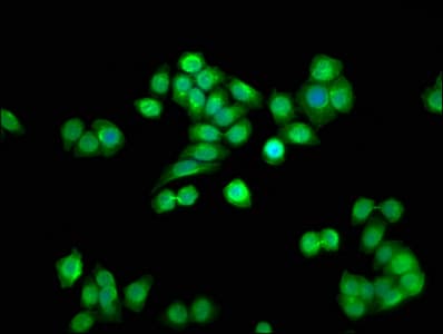 Polyclonal Rabbit anti-Human SSU72 Antibody (C-Terminus)