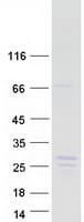 Human NBL1 / DAN Protein (Recombinant Myc-DDK (Flag))