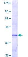 Human CYP27B1 Protein (Recombinant GST, N-terminus)