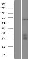 Human ST3GAL4 / ST3Gal IV Protein (Over-Expression Lysate Myc-DDK (Flag))